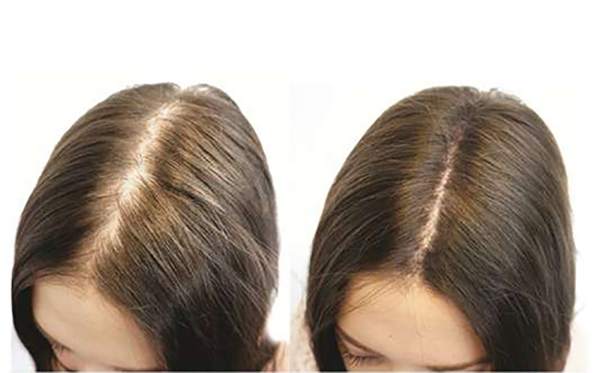 Chăm sóc tóc từ sâu bên trong và sử dụng sản phẩm có thàng phần thiên nhiên